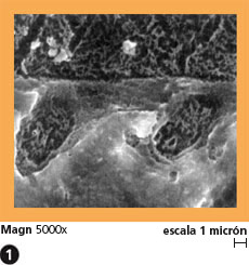 alloybond4_es.jpg