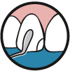 glacier_inst3_en.gif