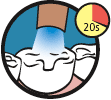 glacier_inst5_en.gif
