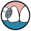 glacier_inst6_en.gif