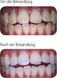 pola_off1_de.jpg