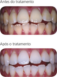 polaoff1_pt.jpg