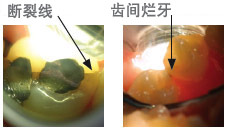 radiiplus6_cn.jpg