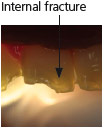 Radii_plus24_en.jpg
