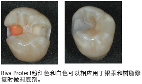 rivaprotect4_cn.jpg