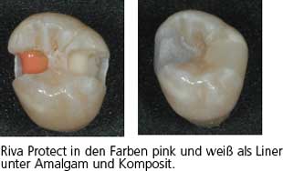 rivaprotect5_de.jpg