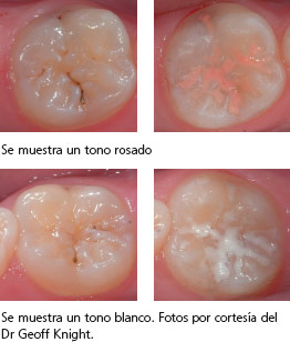 rivaprotect2_es.jpg