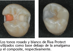 rivaprotect5_es.jpg