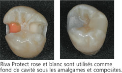 rivaprotect5_fr.jpg