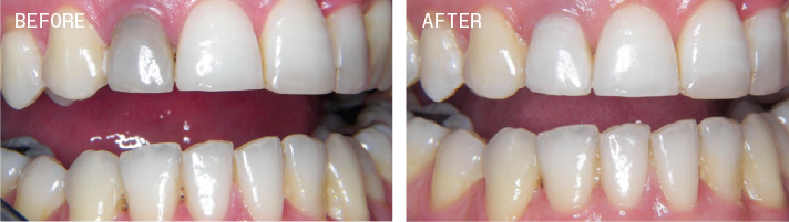 PolaOffice+_beforeAB