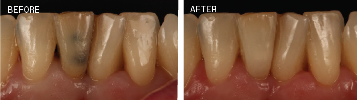 PolaOffice+_beforeBB