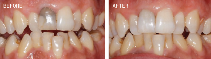 PolaOffice+_beforeCB