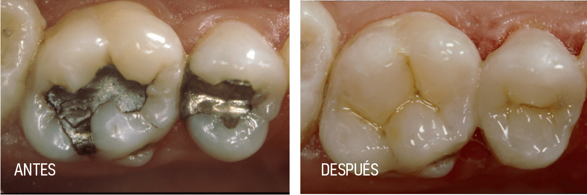 Dental Events Archive - SDI