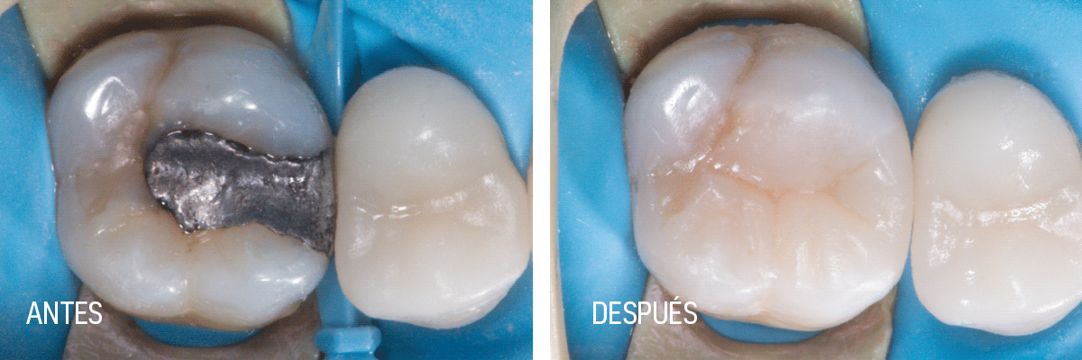 Dental Events Archive - SDI