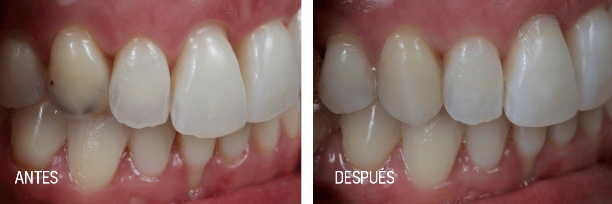 Dental Events Archive - SDI