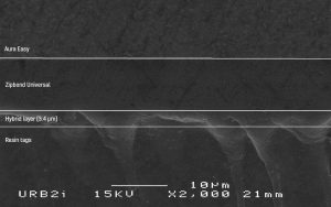 Zipbond Universal Dehydrated Dentine with Etching